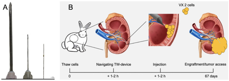 Trans-Vessel Wall Cell Transplantation, Engraftment, and Tumor Access in the VX2 Rabbit Model.