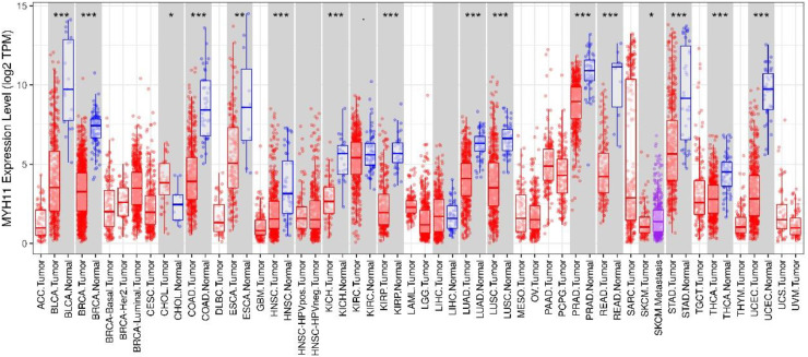 Transcriptional Regulation of NUPR1 by MYH11 Activates PI3 K/AKT and Promotes Bladder Cancer Progression Through Ferroptosis and M2 Polarization of Macrophages.