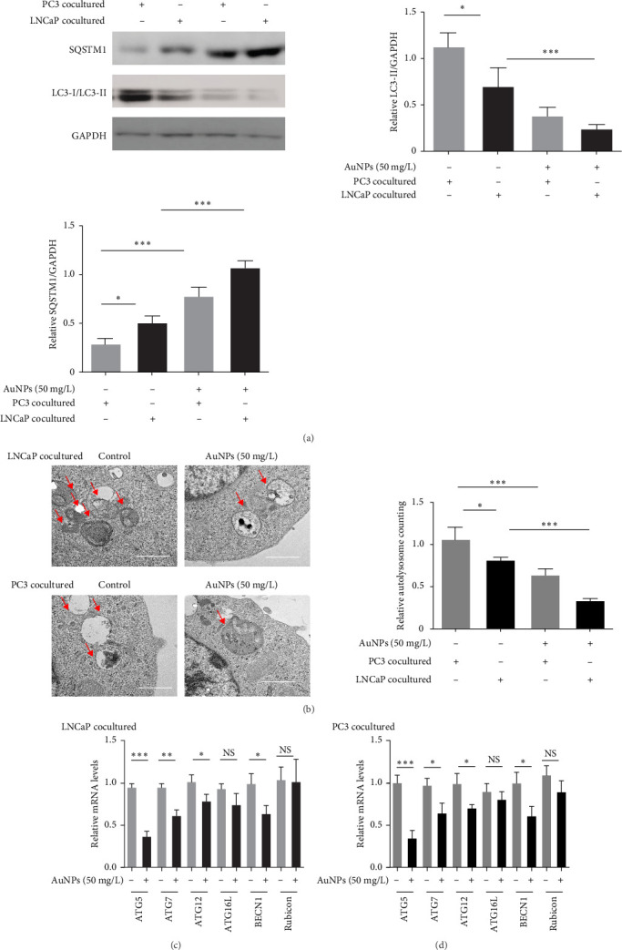Gold Nanoparticle Inhibits the Tumor-Associated Macrophage M2 Polarization by Inhibiting m<sup>6</sup>A Methylation-Dependent ATG5/Autophagy in Prostate Cancer.