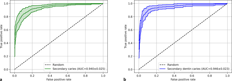 Deep Learning-Based Algorithm for Staging Secondary Caries in Bitewings.