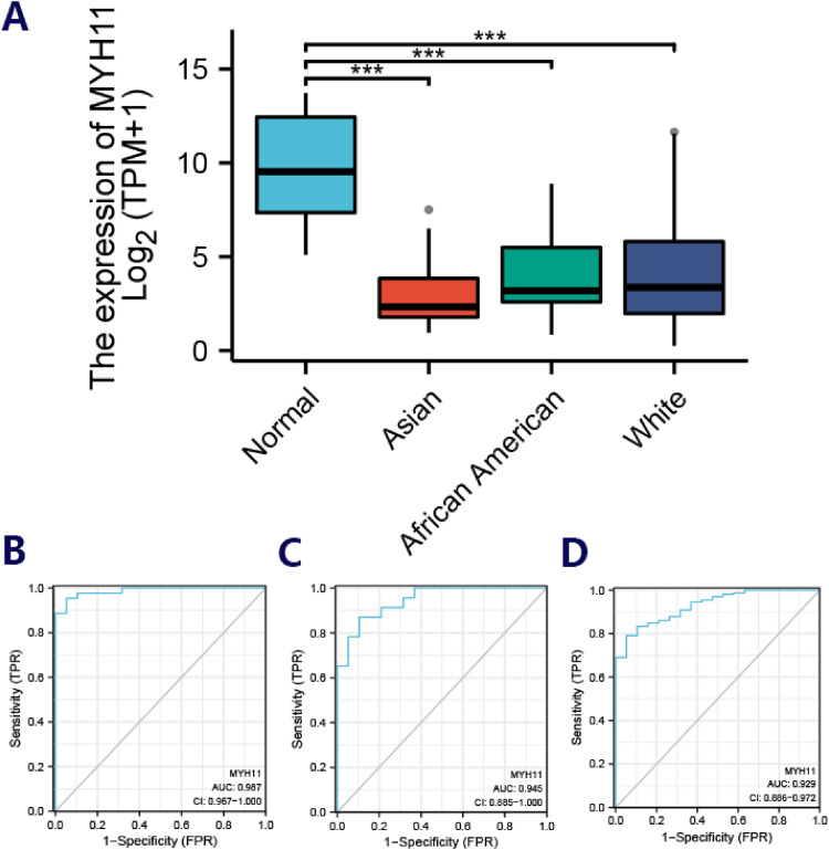 Transcriptional Regulation of NUPR1 by MYH11 Activates PI3 K/AKT and Promotes Bladder Cancer Progression Through Ferroptosis and M2 Polarization of Macrophages.