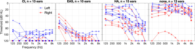 Estimating Cochlear Implant Users' Sound Localization Abilities With Two Loudspeakers.