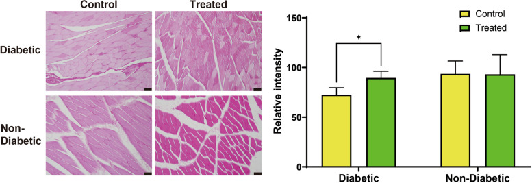 Therapeutic potential of 4-hexylresorcinol in reducing sarcopenia in diabetic masseter muscle.