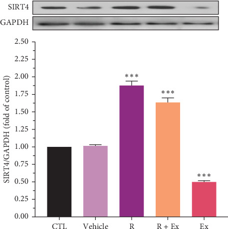 The Antiaging and Antioxidative Effects of a Combination of Resveratrol and High-Intensity Interval Training on the Frontal Lobe in Aged Rats: The Role of SIRTS 4, SIRTS 5, SOD1, and SOD2.