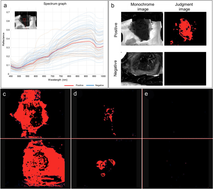 Possibility of determining high quantitative fecal occult blood on stool surface using hyperspectral imaging.