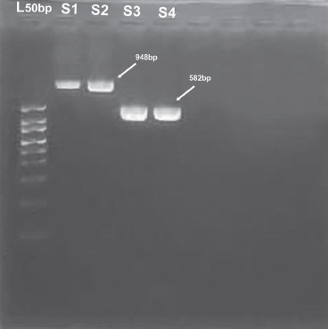 Role of <i>TLR2</i> rs5743708 and dectin-1 rs16910526 polymorphisms in susceptibility to fungal infections in COVID-19 patients.