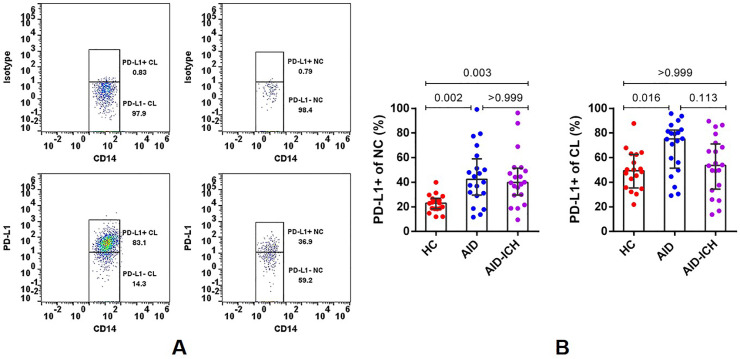 The imbalance of circulating PD-L1-expressing non-classical/ classical monocytes is involved in immunocompromised host related pulmonary opportunistic infection.