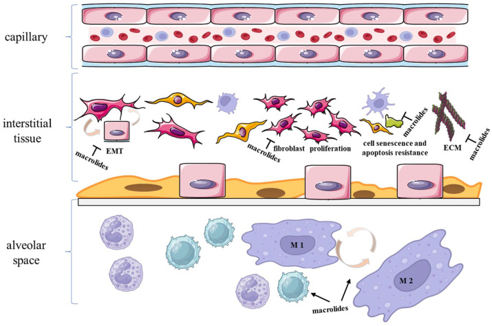 The value of macrolides in the adjuvant treatment of pulmonary fibrosis: maybe a panacea.