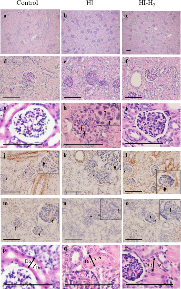Hydrogen gas inhalation ameliorates glomerular enlargement after hypoxic-ischemic insult in asphyxiated piglet model.