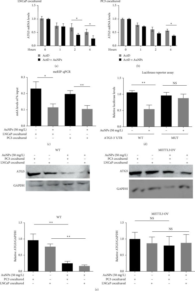 Gold Nanoparticle Inhibits the Tumor-Associated Macrophage M2 Polarization by Inhibiting m<sup>6</sup>A Methylation-Dependent ATG5/Autophagy in Prostate Cancer.