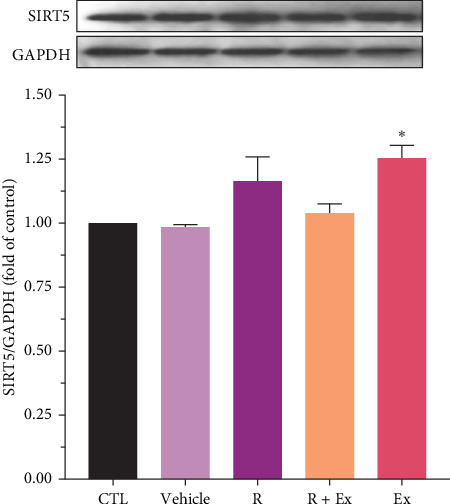 The Antiaging and Antioxidative Effects of a Combination of Resveratrol and High-Intensity Interval Training on the Frontal Lobe in Aged Rats: The Role of SIRTS 4, SIRTS 5, SOD1, and SOD2.