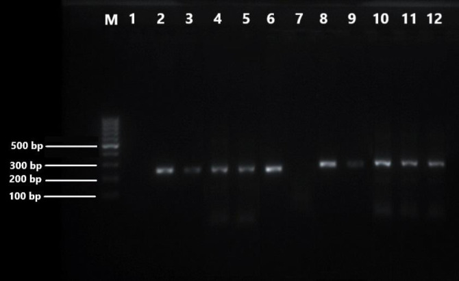 Studies on syndemic infection of porcine reproductive and respiratory syndrome virus with porcine circovirus 2 in backyard pigs of Mizoram, India.