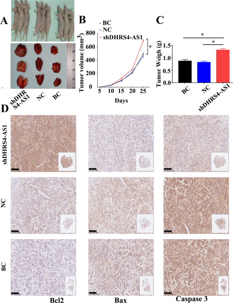 Long noncoding RNA DHRS4 antisense RNA 1 suppresses osteosarcoma cell proliferation and promotes apoptosis through a competitive endogenous RNA mechanism.