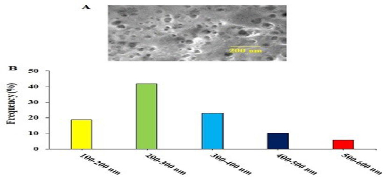 High Prophylactic Efficacy of Thymol Loaded Chitosan Nanoparticles for Controlling Acute Toxoplasmosis in Mice.