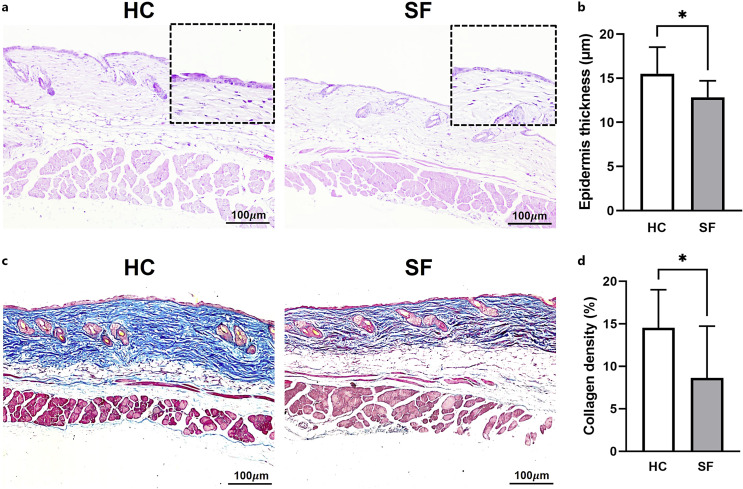 Skin Transcriptomic Analysis Reveals Altered Fatty Acid Metabolism Pathways in Mice Subjected to Sleep Fragmentation.
