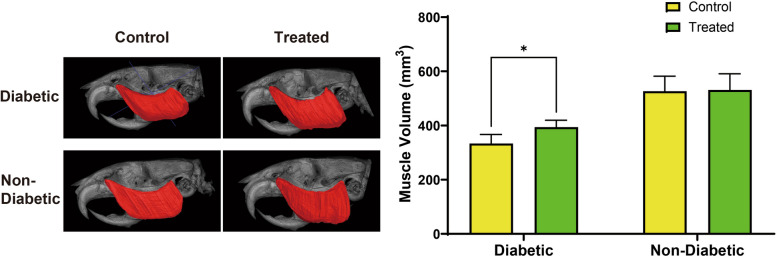 Therapeutic potential of 4-hexylresorcinol in reducing sarcopenia in diabetic masseter muscle.