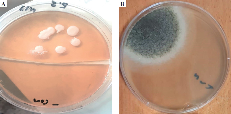 Role of <i>TLR2</i> rs5743708 and dectin-1 rs16910526 polymorphisms in susceptibility to fungal infections in COVID-19 patients.