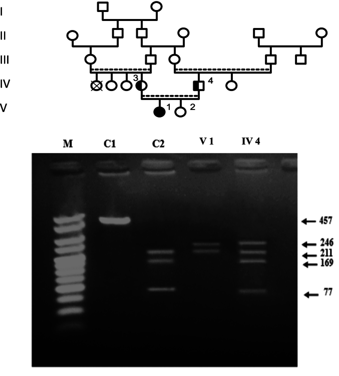 Mucopolysaccharidoses types I and IIIA: Diagnosis and identification of novel polymorphisms associated with common mutations in Moroccan patients