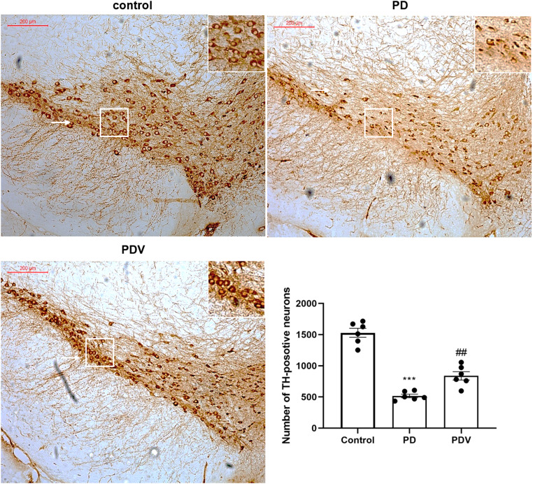 Modulation of Intestinal Inflammation and Protection of Dopaminergic Neurons in Parkinson's Disease Mice through a Probiotic Formulation Targeting NLRP3 Inflammasome.
