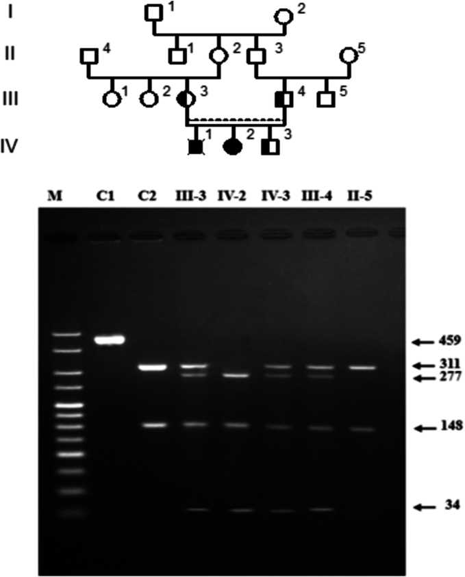 Mucopolysaccharidoses types I and IIIA: Diagnosis and identification of novel polymorphisms associated with common mutations in Moroccan patients