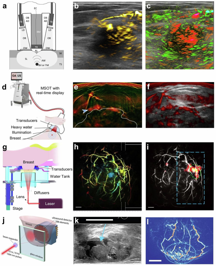 A primer on current status and future opportunities of clinical optoacoustic imaging.