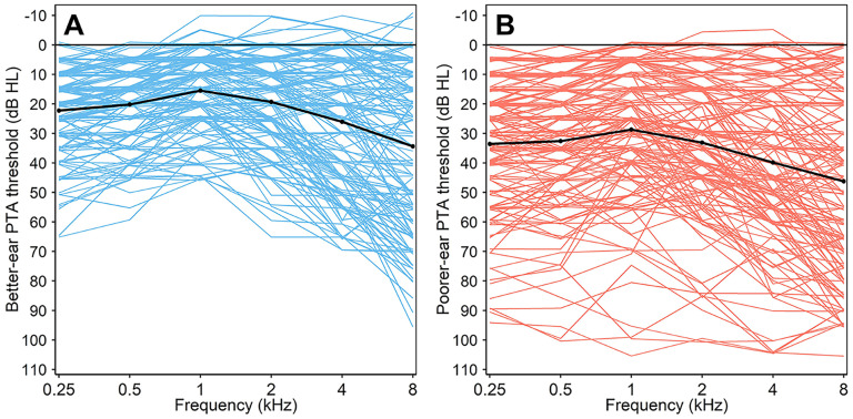 Arabic Digits-in-Noise Tests: Relations to Hearing Loss and Comparison of Diotic and Antiphasic Versions.