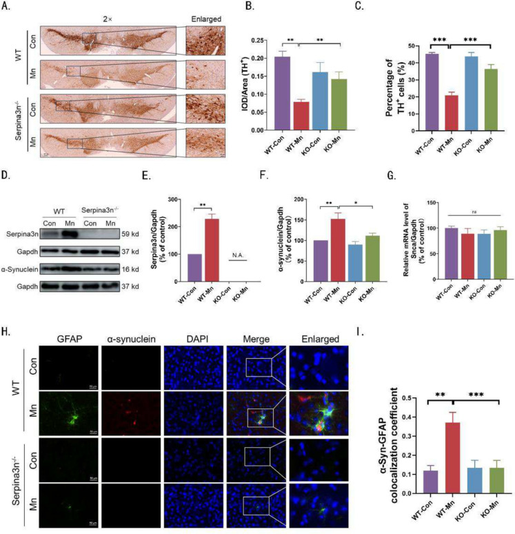 Manganese exposure induces parkinsonism-like symptoms by Serpina3n-TFEB-v/p-ATPase signaling mediated lysosomal dysfunction.