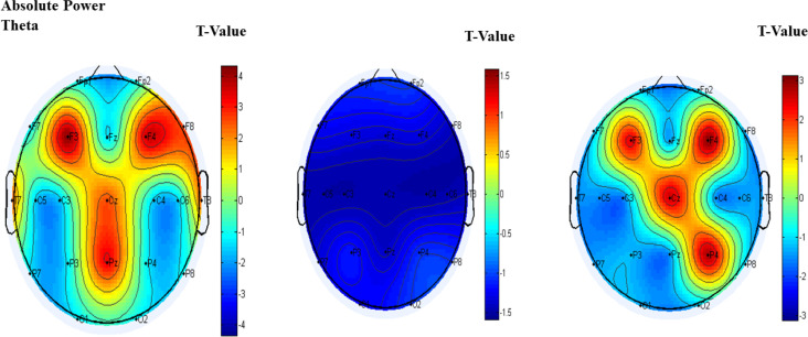 Enhancing EEG Components in Adolescents With ADHD Using Transcranial Electrical Stimulation: A Randomized-active Controlled Study.