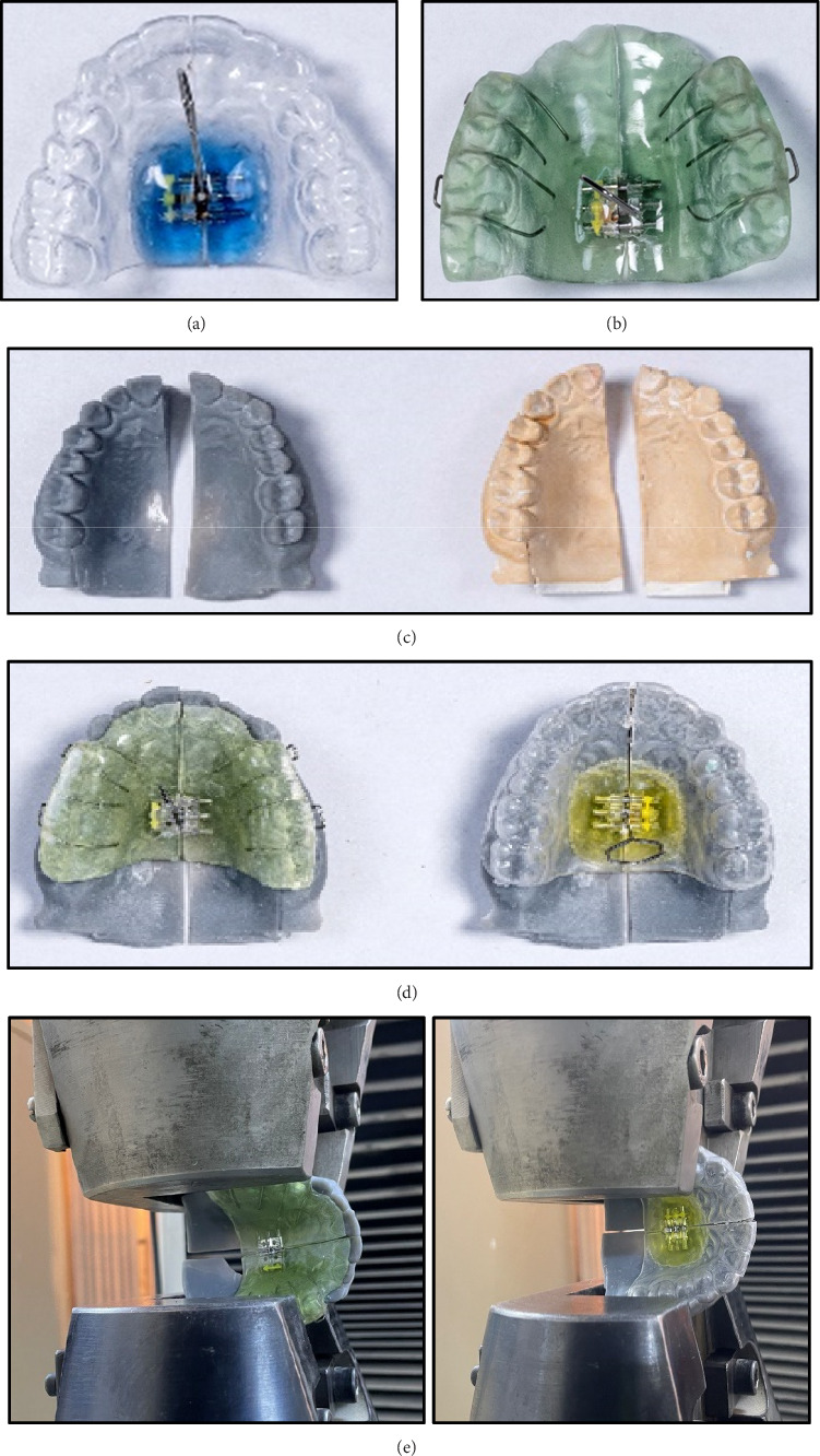 Efficiency of Polyethylene Terephthalate Glycol Thermoplastic Material to Functional and Expansion Forces in Orthodontic Applications: An Experimental Study.