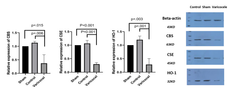 Impact of Varicocele on The Expression of Testicular Enzymes Involved in The Transsulfuration Pathway.