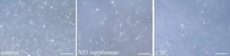 The influence of biomimetic conditions on neurogenic and neuroprotective properties of dedifferentiated fat cells.