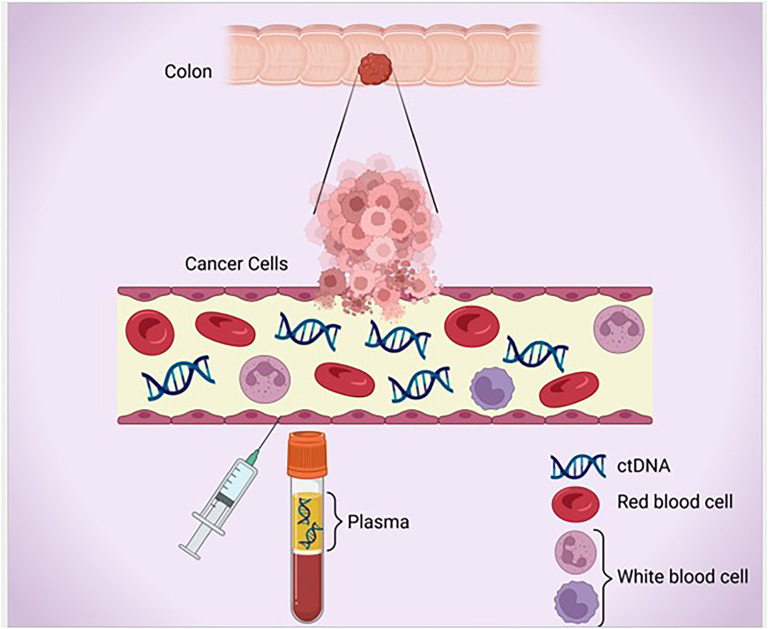Shedding Light on the Prognostic and Predictive Value of Circulating Tumor DNA for Management of Patients with Early-Stage Colon Cancer.