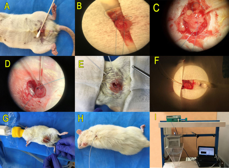 A comprehensive visual report of urodynamic study in rats with spinal cord injury.
