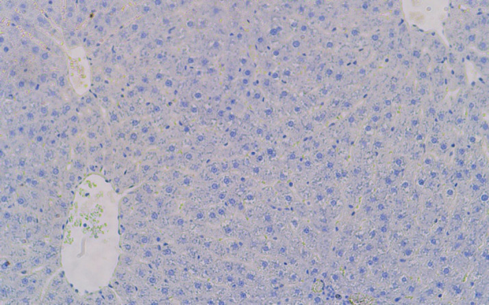 The Modulatory Effects of Statins, Vitamin E, and Moringa Oleifera Extract on CD3 Expression in Ribociclib-Induced Hepatotoxicity in Rats.