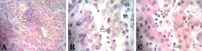 Molecular and histopathological characterization of fowl adenovirus serotype 4 in broiler chickens in Kashan, Iran: implications for disease control and prevention in the poultry industry.