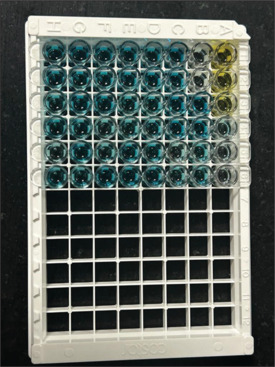 Estimation of the salivary levels of monocyte chemoattractant protein-1 and macrophage inflammatory protein-1α in periodontitis patients with and without diabetes in comparison to systemically and periodontally healthy individuals.