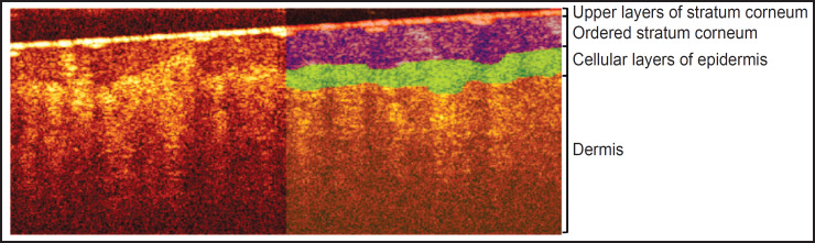 Segmentation of 3D OCT Images of Human Skin Using Neural Networks with U-Net Architecture.