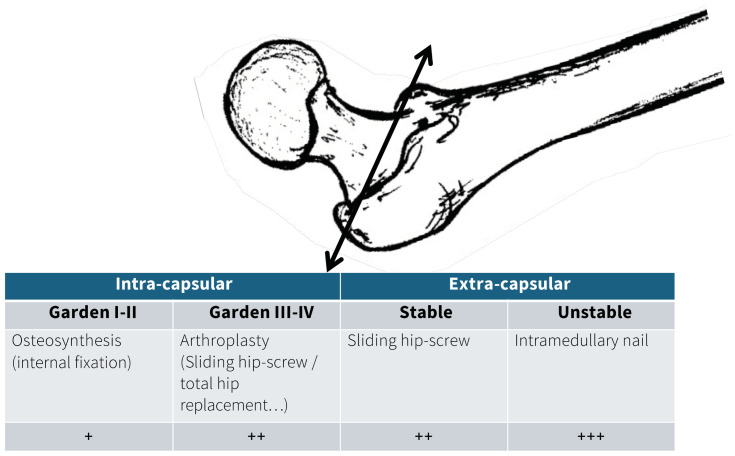 Tranexamic acid in hip fracture repair surgery: safe and effective?