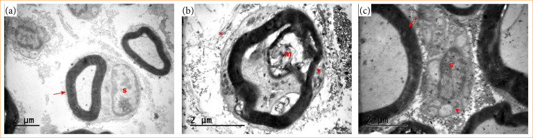 Gallic acid showed neuroprotection against endoplasmic reticulum stress in rats.
