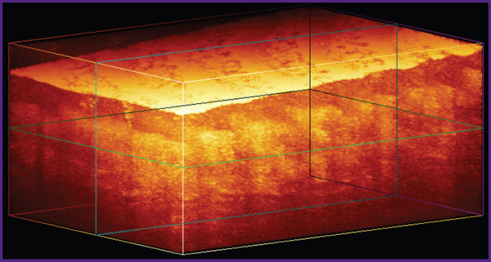 Segmentation of 3D OCT Images of Human Skin Using Neural Networks with U-Net Architecture.