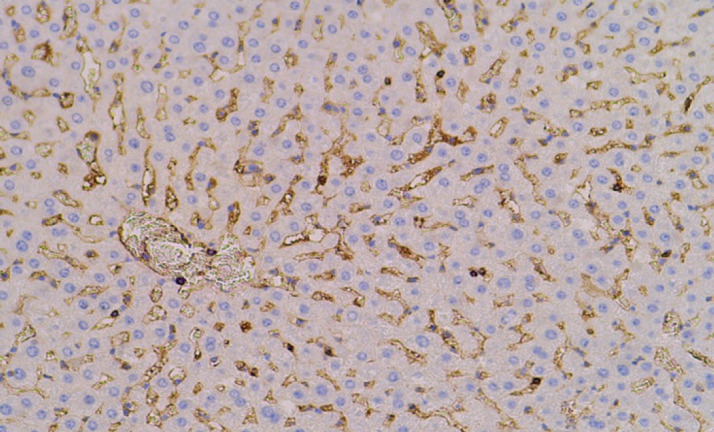 The Modulatory Effects of Statins, Vitamin E, and Moringa Oleifera Extract on CD3 Expression in Ribociclib-Induced Hepatotoxicity in Rats.