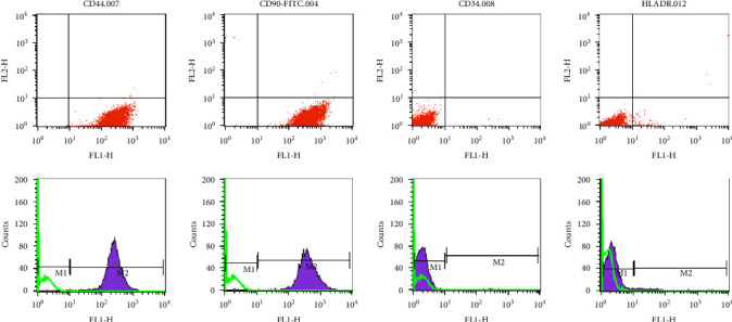 Exosome Loaded in Microneedle Patch Ameliorates Renal Ischemia-Reperfusion Injury in a Mouse Model.