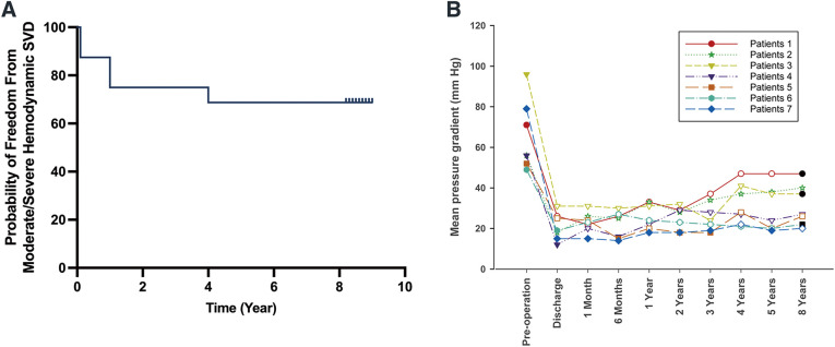 Eight-Year Clinical Outcomes of Transcatheter Aortic Valve Replacement with J-Valve System.