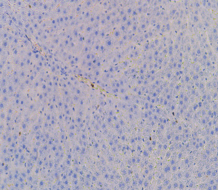 The Modulatory Effects of Statins, Vitamin E, and Moringa Oleifera Extract on CD3 Expression in Ribociclib-Induced Hepatotoxicity in Rats.