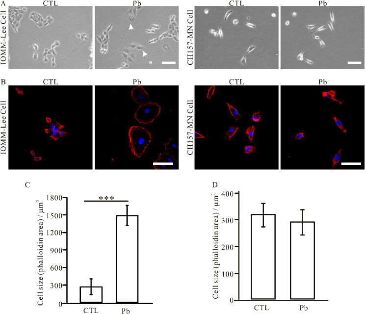 Lead exposure promotes NF2-wildtype meningioma cell proliferation through the Merlin-Hippo signaling pathway.