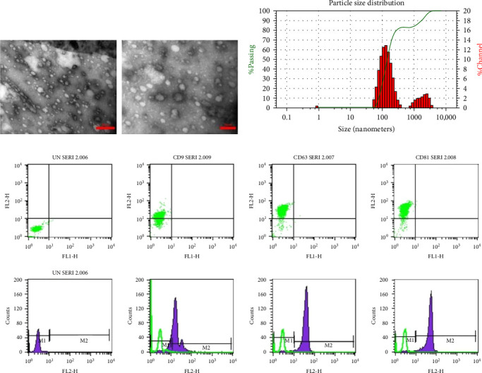 Exosome Loaded in Microneedle Patch Ameliorates Renal Ischemia-Reperfusion Injury in a Mouse Model.