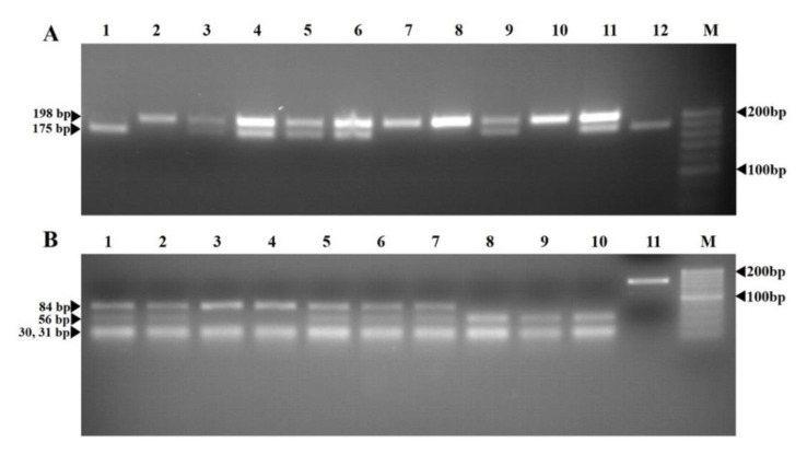 The Relationship between Homocysteine Levels, <i>MTHFR C677T and A1298C</i> Polymorphism, and Pregnancy Outcomes in Georgian Women with Polycystic Ovary Syndrome: A Case-Control Study.