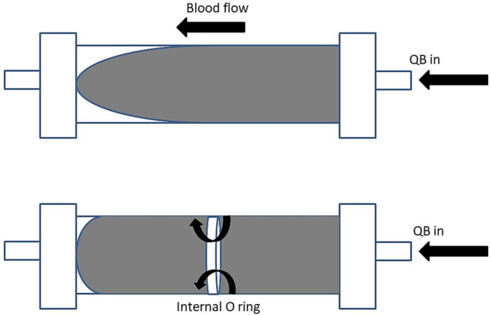 The changing face of dialyzer membranes and dialyzers.