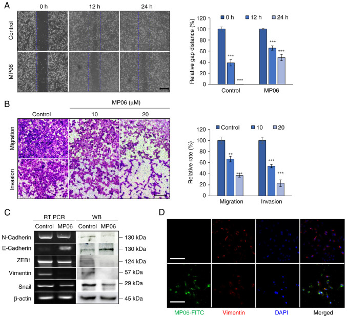 Anti‑angiogenic effect of <i>Bryopsis plumosa</i>‑derived peptide via aquaporin 3 in non‑small cell lung cancer.
