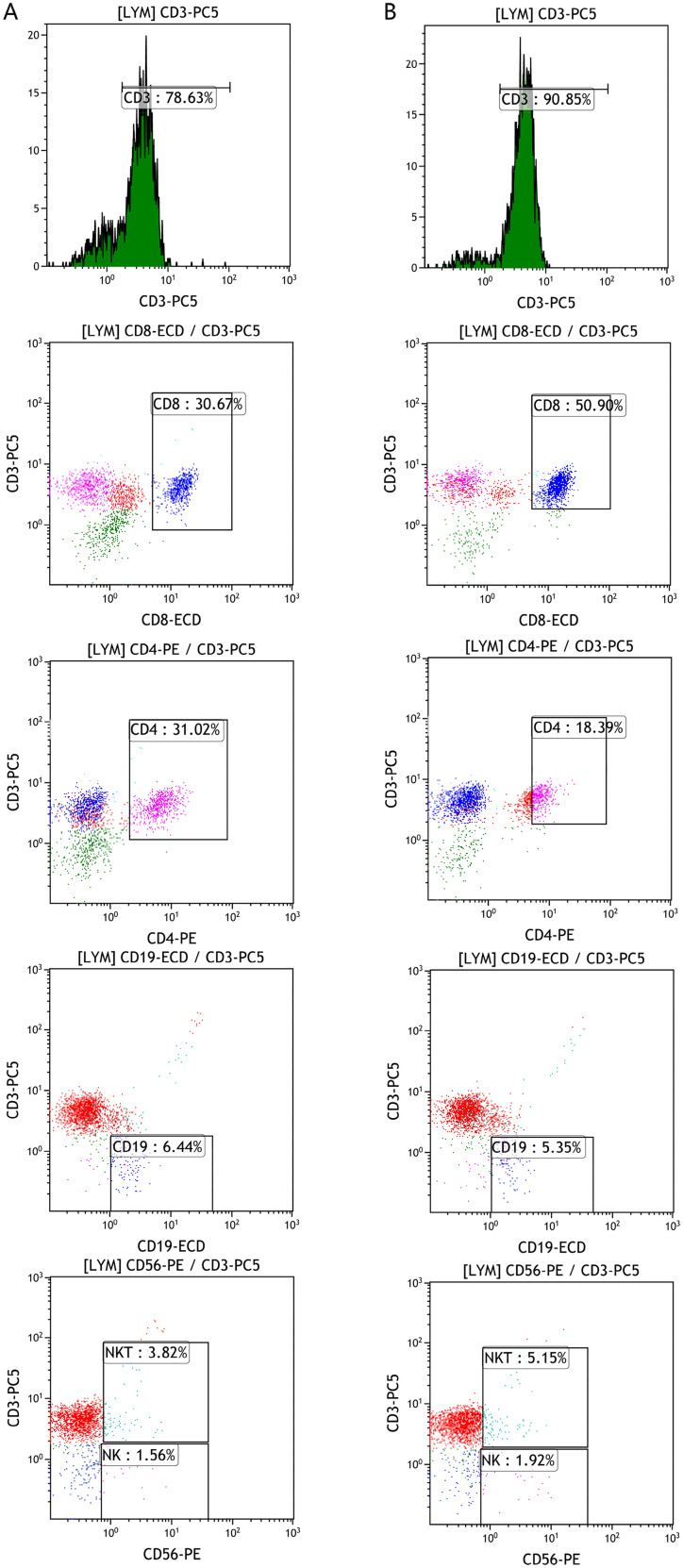 HER2-Targeted Nanoliposome Therapy Activates Immune Response by Converting Cold to Hot Breast Tumors.